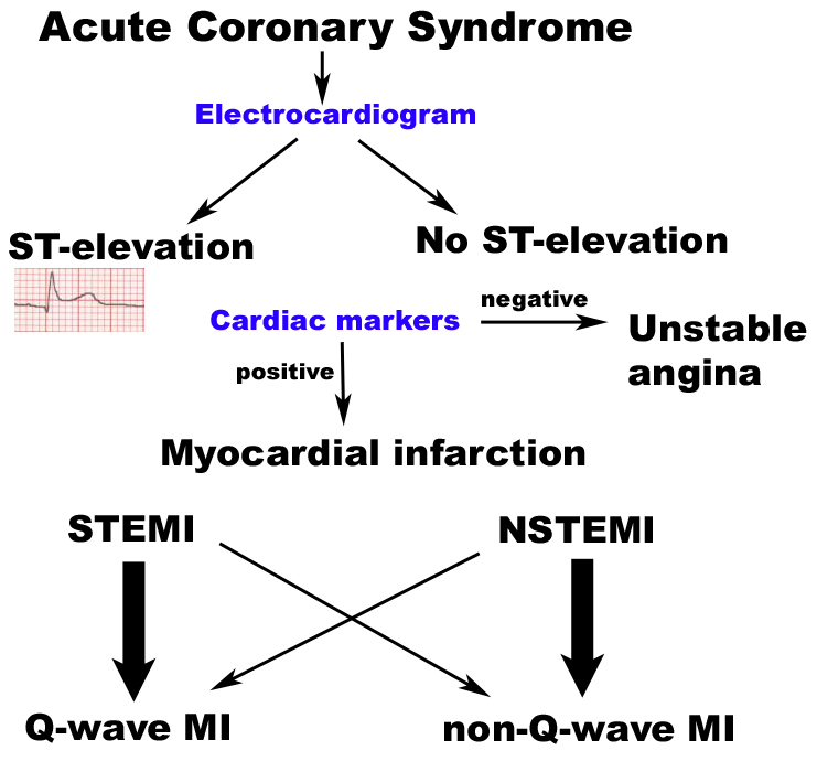 Acute Coronary Syndrome