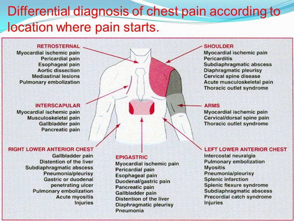 Differential Diagnosis of Chest Pain